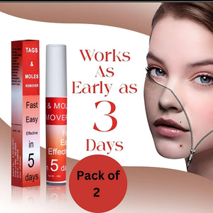 Tags & Moles Remover (BUY 1 GET 1 FREE) (98999+++Happy Customer ⭐⭐⭐⭐⭐)