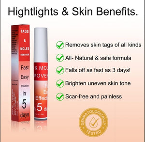 Tags & Moles Remover (BUY 1 GET 1 FREE) (98999+++Happy Customer ⭐⭐⭐⭐⭐)